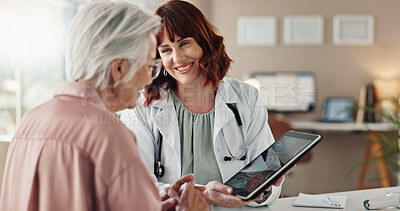 Buy stock photo Senior patient, brain scan or doctor with tablet for good news, research or medical diagnosis in hospital. Neurology advice, women or results on touchscreen for healthcare, MRI exam or test feedback