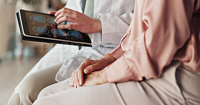 Buy stock photo Hands, patient and doctor with tablet, screen and healthcare with neurosurgeon. Dementia, medical or elderly person in office, diagnosis or tech for results, aneurysm or professional with brain scans