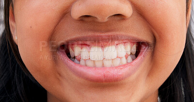 Buy stock photo Smile, teeth and closeup of child in city for happiness, orthodontist and dental health. Pride, wellness and oral hygiene with zoom of mouth of person in outdoor for confidence, gum care and lips