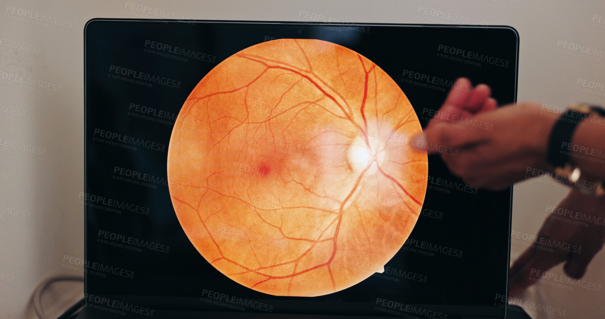 Buy stock photo Hands, eye scan and screen in optometry for doctor, consultation and examination for vision health. Person, retina and medical advice on technology in clinic for optical wellness, therapy or analysis
