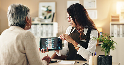 Buy stock photo Senior patient, doctor and tablet with xray in clinic for medical diagnosis, spinal tumor or cancer cells. Neurologist, woman or digital screen for explaining scan, surgery feedback or health support
