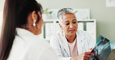 Buy stock photo Healthcare, results or x ray with doctor and patient in office of hospital for consulting. Diagnosis, pointing or radiology with mature medicine professional and woman in clinic for medical feedback