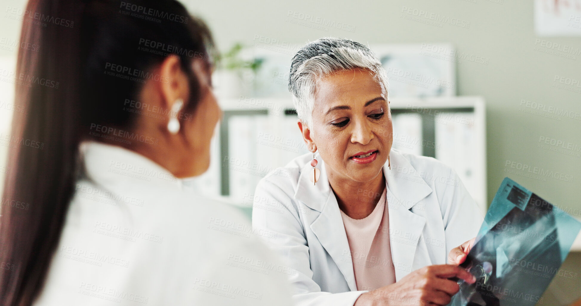 Buy stock photo Healthcare, results or x ray with doctor and patient in office of hospital for consulting. Diagnosis, pointing or radiology with mature medicine professional and woman in clinic for medical feedback