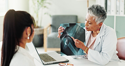 Buy stock photo Appointment, medical or x ray with doctor and patient in office of hospital for consulting. Conversation, healthcare or radiology with mature medicine professional and woman in clinic for diagnosis