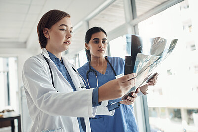 Buy stock photo Doctor, nurse and scan in xray for radiology in hospital or clinic for patient, consultation and results for treatment. Medical, professionals and discussion in healthcare as specialist for diagnosis