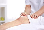An unrecognizable woman getting needles inserted into her knee during an acupuncture session. Closeup of patient getting alternative therapy for medical treatment