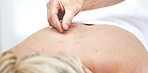An unrecognizable woman getting needles inserted into her back during an acupuncture session. Closeup of patient getting alternative therapy for medical treatment
