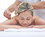 A young woman getting needles inserted into her back during an acupuncture session. A patient getting alternative therapy for medical treatment