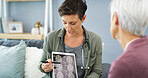 Doctor, patient and healthcare with tablet for brain scan, cancer diagnosis with CT results and consultation. Explain MRI, treatment plan and surgeon with senior woman for neurology update on screen