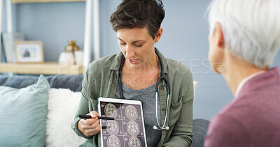 Buy stock photo Doctor, patient and healthcare with tablet for brain scan, cancer diagnosis with CT results and consultation. Explain MRI, treatment plan and surgeon with senior woman for neurology update on screen