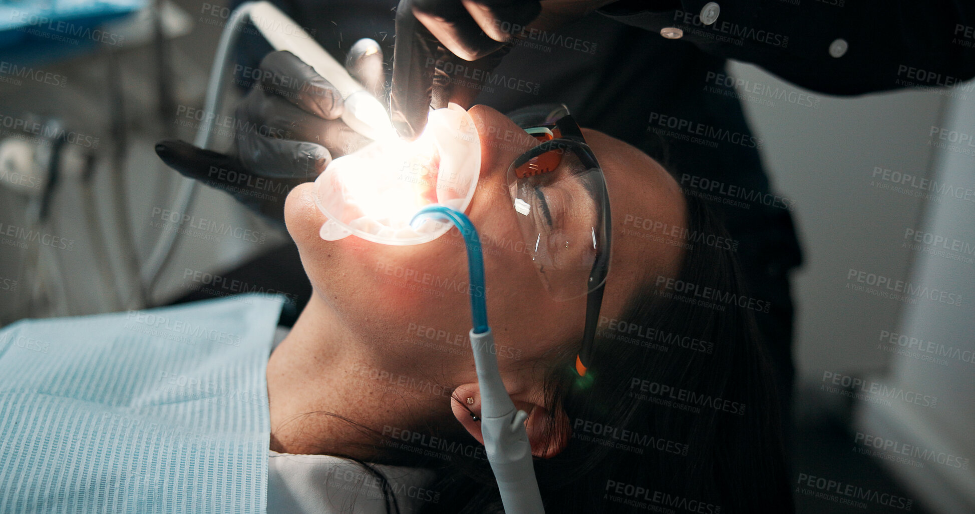 Buy stock photo Appointment, mouth surgery and patient with dentist in office for checkup or medical operation. Dental hygiene, oral exam or procedure with medicine professional and woman at clinic for healthcare