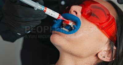 Buy stock photo Hands, mouth and visor on patient with dentist in office for checkup or teeth whitening. Dental hygiene, healthcare or oral cleaning with medicine professional and woman at clinic for dentistry