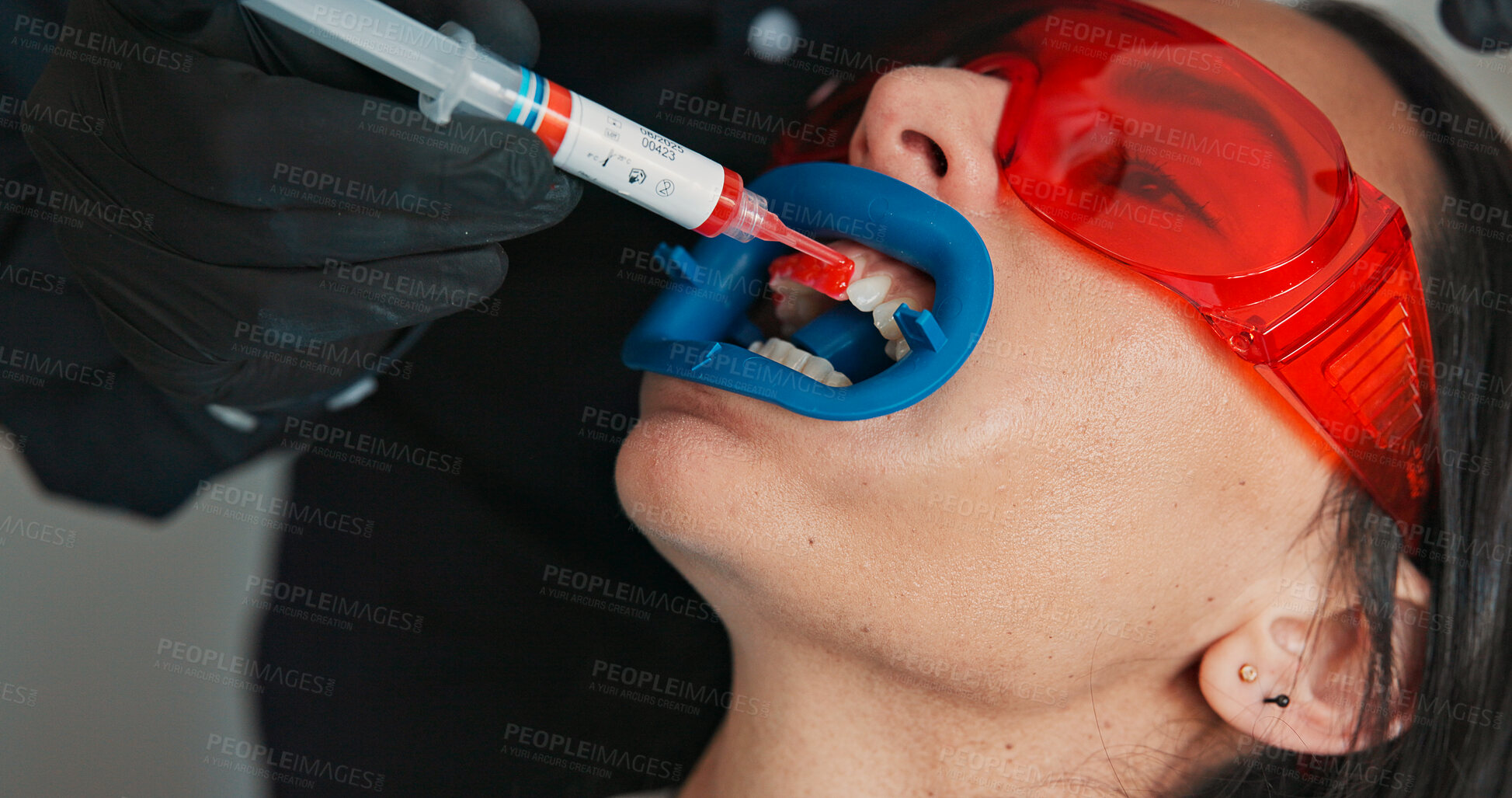 Buy stock photo Hands, mouth and visor on patient with dentist in office for checkup or teeth whitening. Dental hygiene, healthcare or oral cleaning with medicine professional and woman at clinic for dentistry