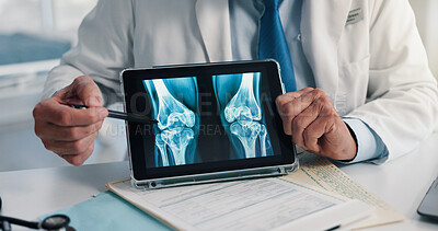 Buy stock photo Hands, screen and tablet for x ray with knee, scan or osteoporosis with point at hospital. Doctor, application and ux for medical consultation for arthritis, feedback or report for wellness at clinic