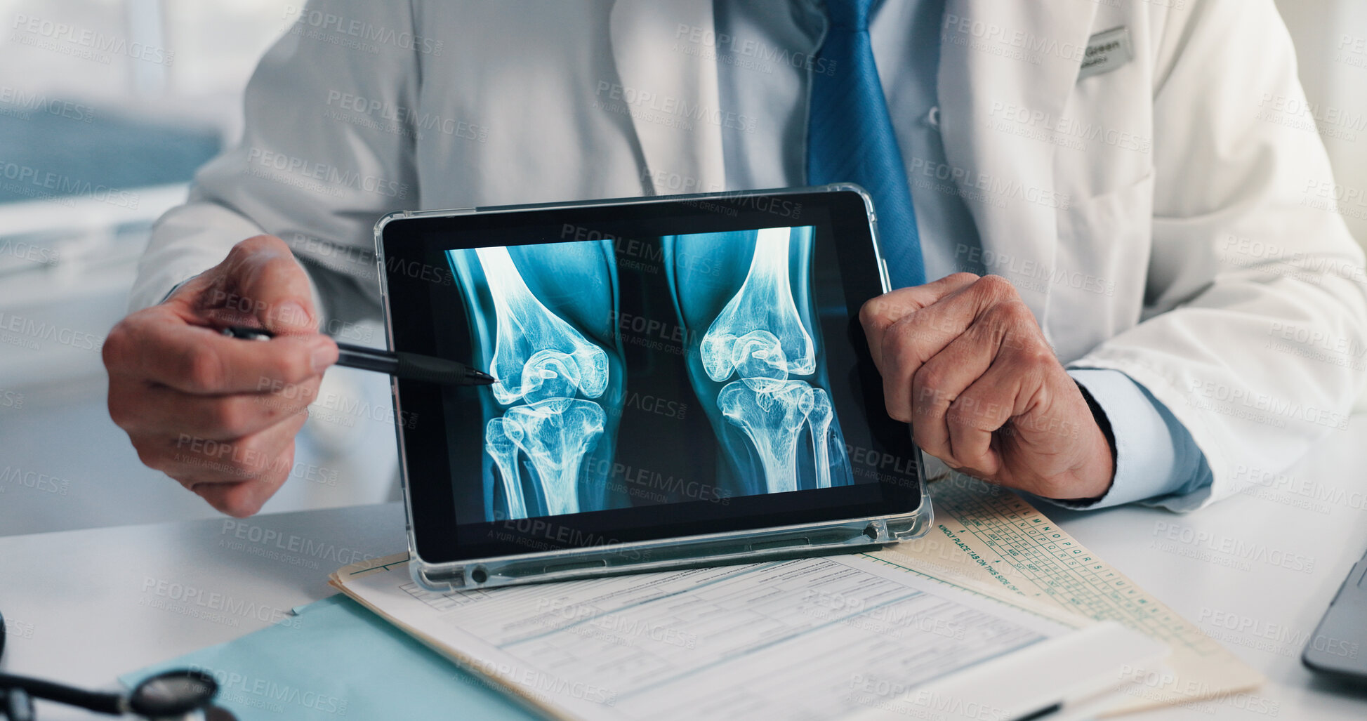 Buy stock photo Hands, screen and tablet for x ray with knee, scan or osteoporosis with point at hospital. Doctor, application and ux for medical consultation for arthritis, feedback or report for wellness at clinic