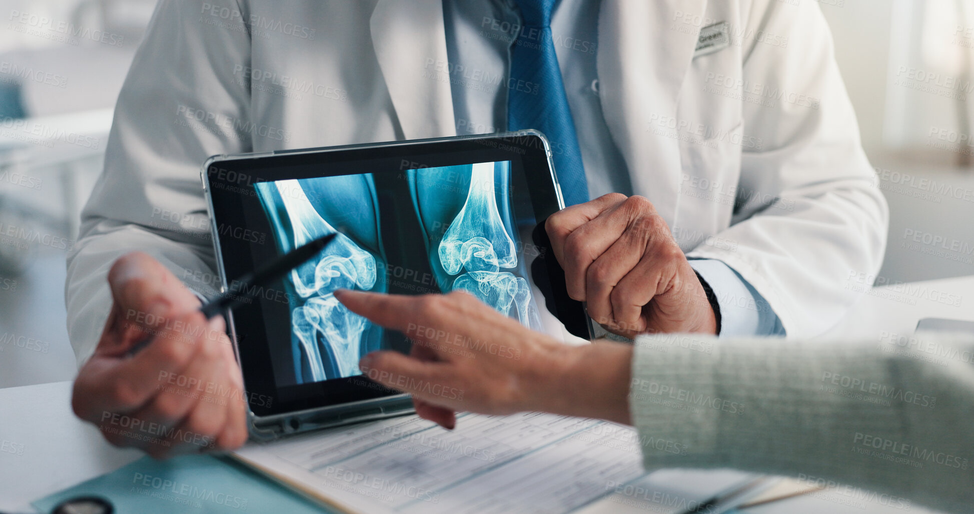 Buy stock photo Hands, doctor and tablet for x ray with knee, scan or osteoporosis with point at hospital. People, application and ux for medical consultation for arthritis, feedback or report for wellness at clinic
