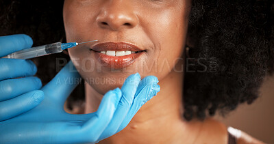 Buy stock photo Plastic surgery, lip filler and mouth of woman with gloves for skincare, facial implant and beauty. Dermatology, closeup and face of person with needle for cosmetics, anti aging and transformation