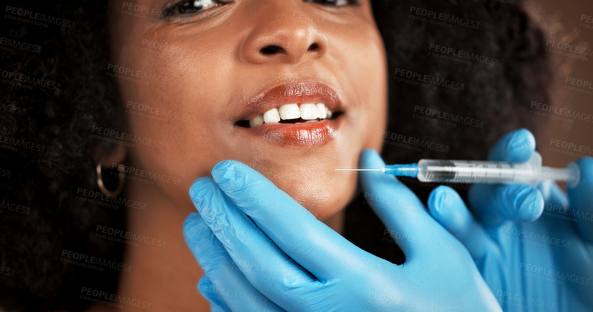 Buy stock photo Plastic surgery, lip filler and face of woman with gloves for skincare, facial implant and beauty. Dermatology, studio background and African person with needle for cosmetics, anti aging and change
