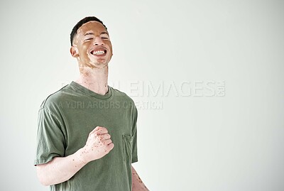 Happy, portrait and man with vitiligo on skin with achievement, pride and confidence in studio background. Natural, beauty and winning dermatology promo, treatment and celebration of unique identity