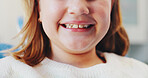 Happy girl, mouth and dentist with teeth for dental hygiene, checkup or appointment at clinic. Closeup, child or kid with big smile for medical orthodontist, tooth surgery or oral and gum healthcare