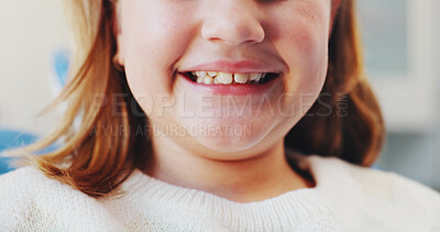 Buy stock photo Happy girl, mouth and dentist with teeth for dental hygiene, checkup or appointment at clinic. Closeup, child or kid with big smile for medical orthodontist, tooth surgery or oral and gum healthcare