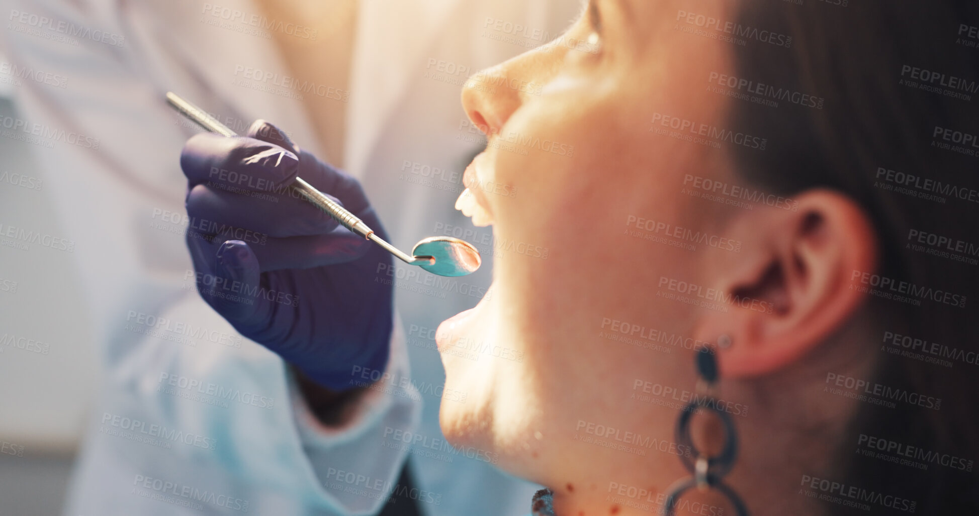 Buy stock photo Dental mirror, consultation and dentist with woman for treatment of tooth decay, cavity or oral care. Checkup, health and orthodontist with female patient for procedure with medical tool in clinic.