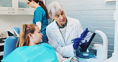 Buy stock photo Child, explain and dentist with teeth on tablet for screen, extraction information and diagnosis. Dentistry, girl kid and mature woman in practice for dental implant and tooth alignment procedure