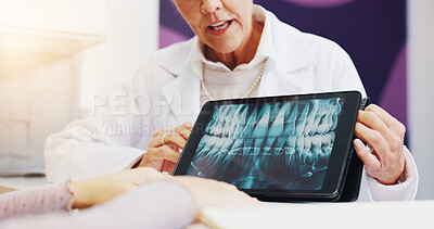 Buy stock photo Woman, dentist and tablet screen for x ray, teeth diagnosis or plan for healthcare treatment. Clinic, patient and dental surgeon with digital tech for tooth structure, advice or orthodontic procedure