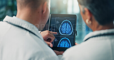 Buy stock photo Hands, doctors and tablet for brain scan, neurology and MRI on screen for team collaboration at clinic. People, medical research and healthcare professional with app, xray or neuroscience at hospital