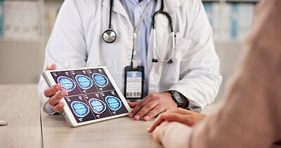 Buy stock photo MRI, doctor or patient hands with tablet for consultation, follow up appointment or test results. Healthcare, tech or people with brain scan to monitor diagnosis, neurology clinic or xray specialist