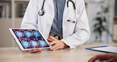 Buy stock photo Brain scan, doctor hands or patient with tablet screen for consultation, follow up appointment or result. Healthcare, tech or people with mri to monitor diagnosis, neurology clinic or xray specialist