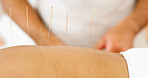 Back, person and needles for acupuncture at spa for muscle tension, natural pain relief and healing. Closeup, people and traditional medicine for physical therapy, joint inflammation and self care