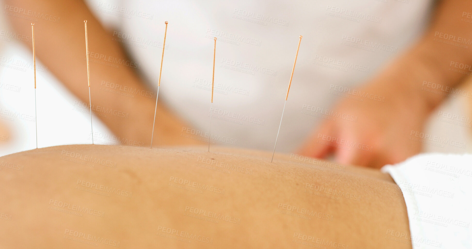Buy stock photo Back, person and needles for acupuncture at spa for muscle tension, natural pain relief and healing. Closeup, people and traditional medicine for physical therapy, joint inflammation and self care