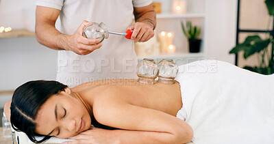 Buy stock photo Woman, spa and cupping therapy for back pain, healing and relax for muscle blood flow and benefits. Therapist, person and patient on bed for wellness, health and resort with deep tissue massage