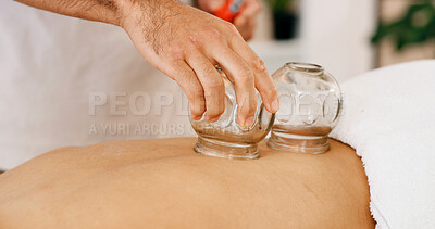 Buy stock photo Hands, glass and cupping therapy for back pain, healing and relax for muscle blood flow and benefits. Therapist, holistic spa and person on bed for wellness, health or resort with deep tissue massage