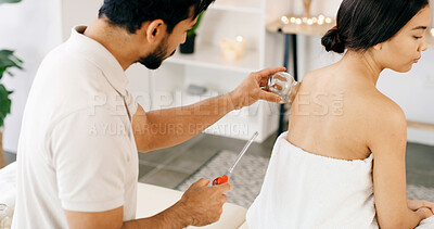 Buy stock photo People, lighter and cupping therapy for back pain, relax and healing for muscle blood flow benefits. Therapist, holistic spa and woman with man for wellness, health or resort with deep tissue massage