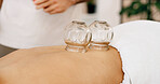 Hands, glass and cupping therapy for back pain, relax and healing for muscle blood flow and benefits. Therapist, holistic spa and person on bed for wellness, health or resort with deep tissue massage