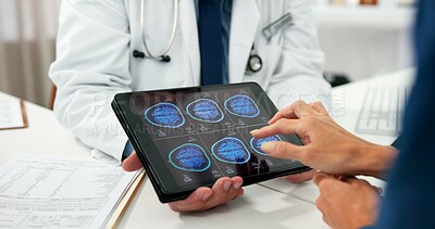 Buy stock photo Brain scan, hands and tablet screen with people in hospital for radiology or results review. Consulting, healthcare and medical with doctor speaking to patient for discussion of digital MRI image