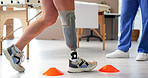Nurse, patient or disc with cones on prosthetic leg for mobility training or balance in clinic. Physiotherapist, walking and helping person with a disability on obstacles for rehabilitation or aid