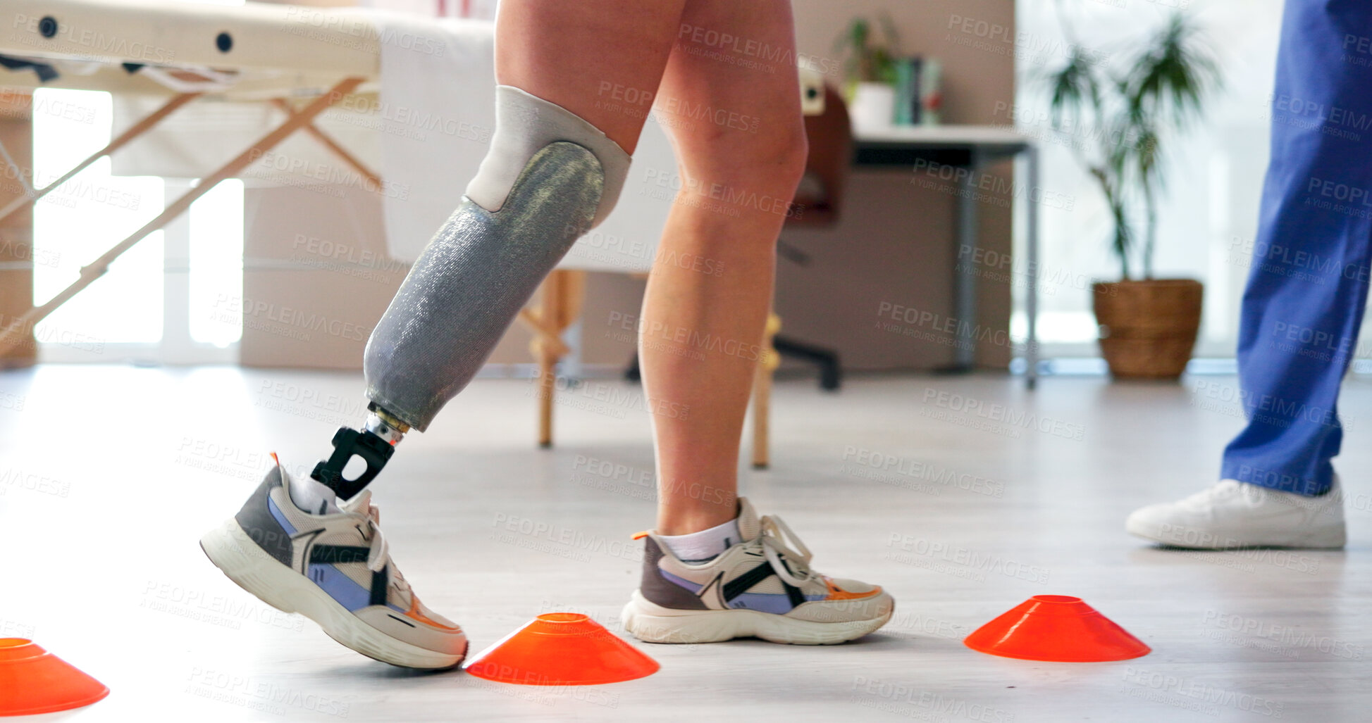 Buy stock photo Doctor, patient or disc with cones on prosthetic leg for mobility training or balance in clinic. Physiotherapist, walking and helping person with a disability on obstacles for rehabilitation or aid