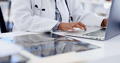 Buy stock photo Hospital, typing and hands of doctor on laptop for online schedule, patient report and research. Healthcare, x ray and woman on computer for digital scan, insurance and results for medical service