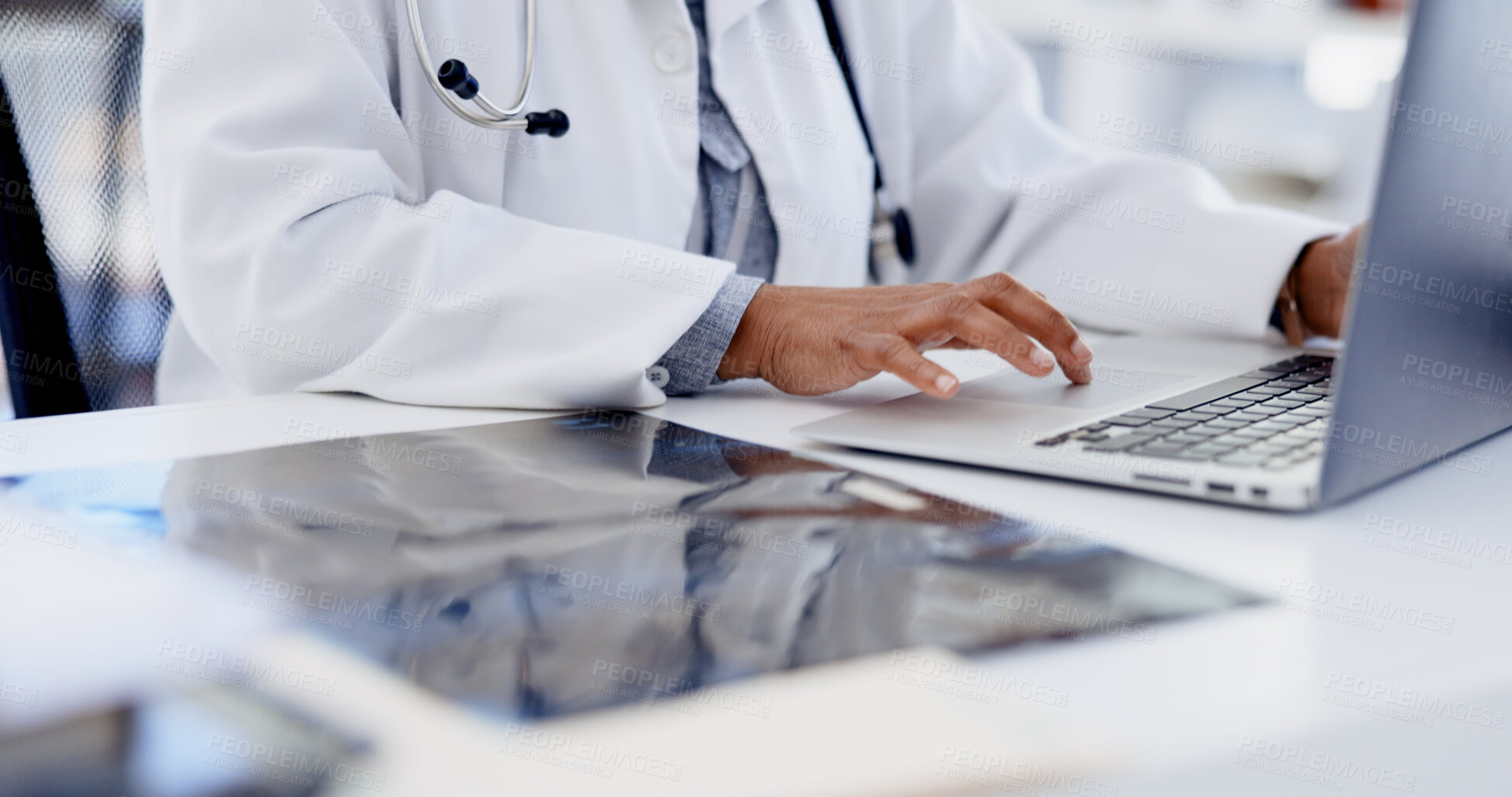 Buy stock photo Hospital, typing and hands of doctor on laptop for online schedule, patient report and research. Healthcare, x ray and woman on computer for digital scan, insurance and results for medical service