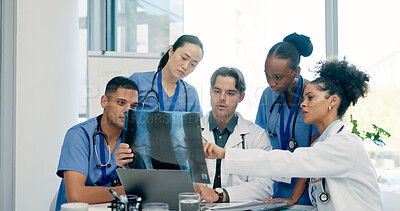 Buy stock photo Doctor, nurse and x ray in hospital with discussion, laptop or medical research for disease diagnosis. Healthcare worker, people and conversation with bones scan, teamwork or advice for test results.