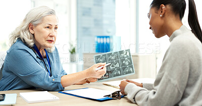 Buy stock photo Doctor, scan and pregnant woman in clinic, talking and fertility report for ivf progress. Gynecology, pregnancy news or people in hospital, ultrasound for growth and family planning with diagnosis