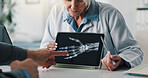 Hands, doctor and patient with tablet for x ray exam, test results or medical procedure in hospital. People, healthcare worker or bone structure with technology, screen or display for CT scan or MRI