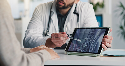 Buy stock photo Doctor, hands and tablet screen with x ray, patient and review results for healthcare diagnosis. Tech, people and consultation with radiology scan, bone fracture and medical assessment in clinic