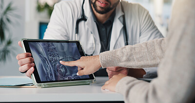 Buy stock photo Doctor, hands and tablet screen with x ray, consultation and healthcare results for pelvic injury. Tech, people and patient with radiology scan, bone fracture or point for medical question in clinic