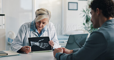 Buy stock photo Tablet screen, doctor and consulting man with xray for bone tumor, abnormal growth or diagnosis. Health, professional and patient with hand scan for joint fracture, assess damage and clinic follow up
