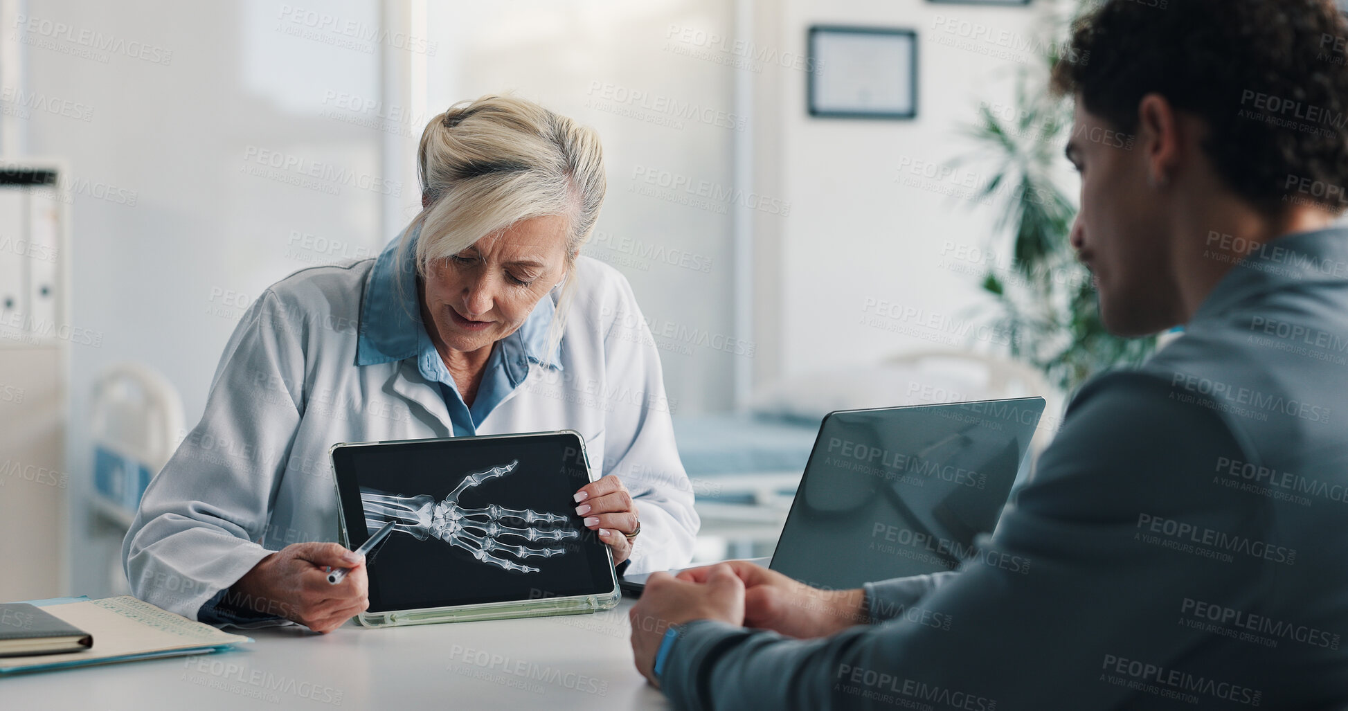 Buy stock photo Tablet screen, doctor and consulting man with xray for bone tumor, abnormal growth or diagnosis. Health, professional and patient with hand scan for joint fracture, assess damage and clinic follow up