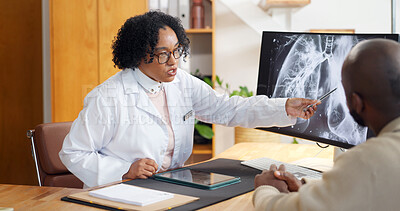 Buy stock photo Doctor, patient and consultation with xray on screen, cancer or lung disease with scan for healthcare. Oncologist, person and monitor with MRI, surgery or cardiovascular medicine with conversation